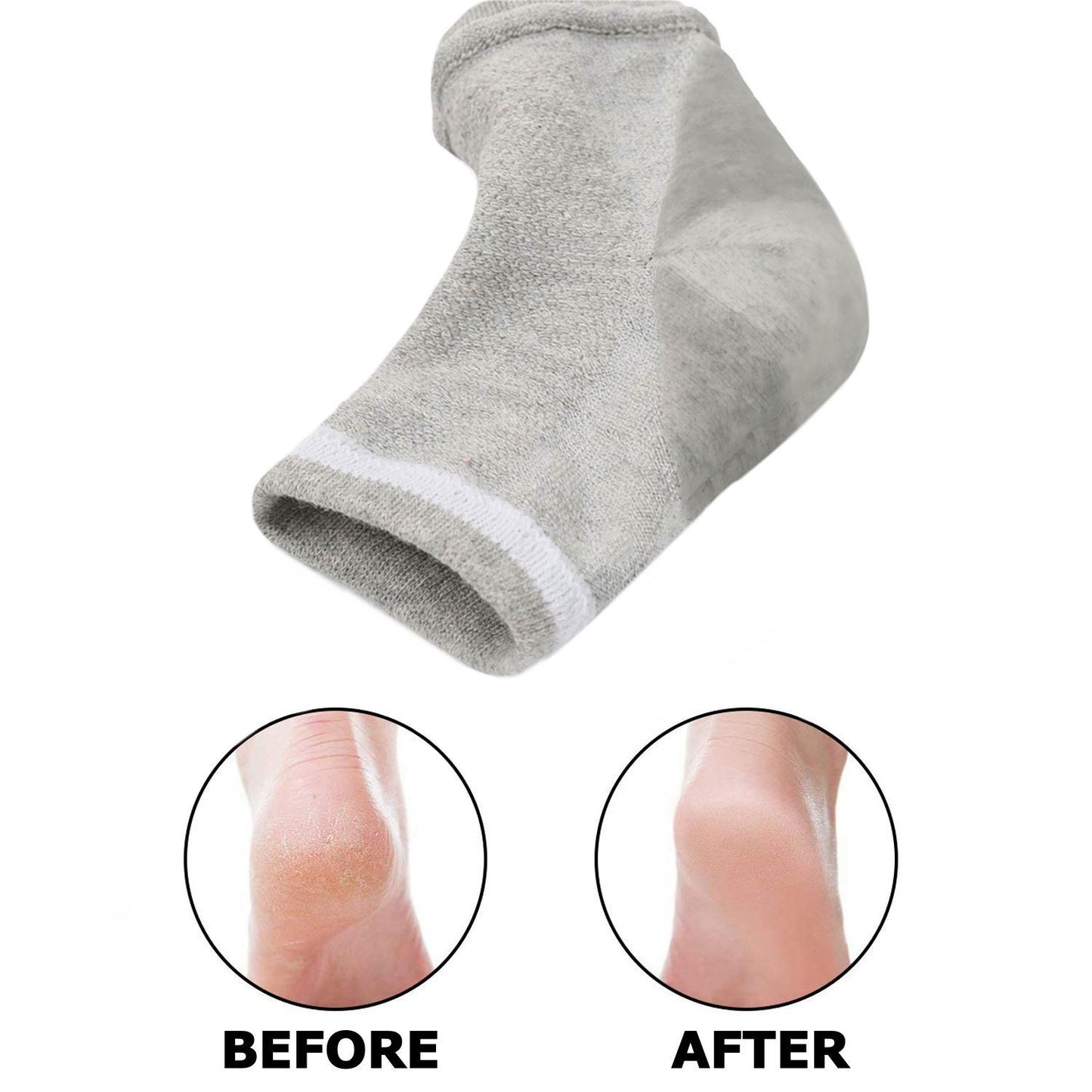 Moisturizing Gel Heel Socks Open Toe for Dry, Hard, Rough, and Cracked Skin - Treatment Care for Softer Heel