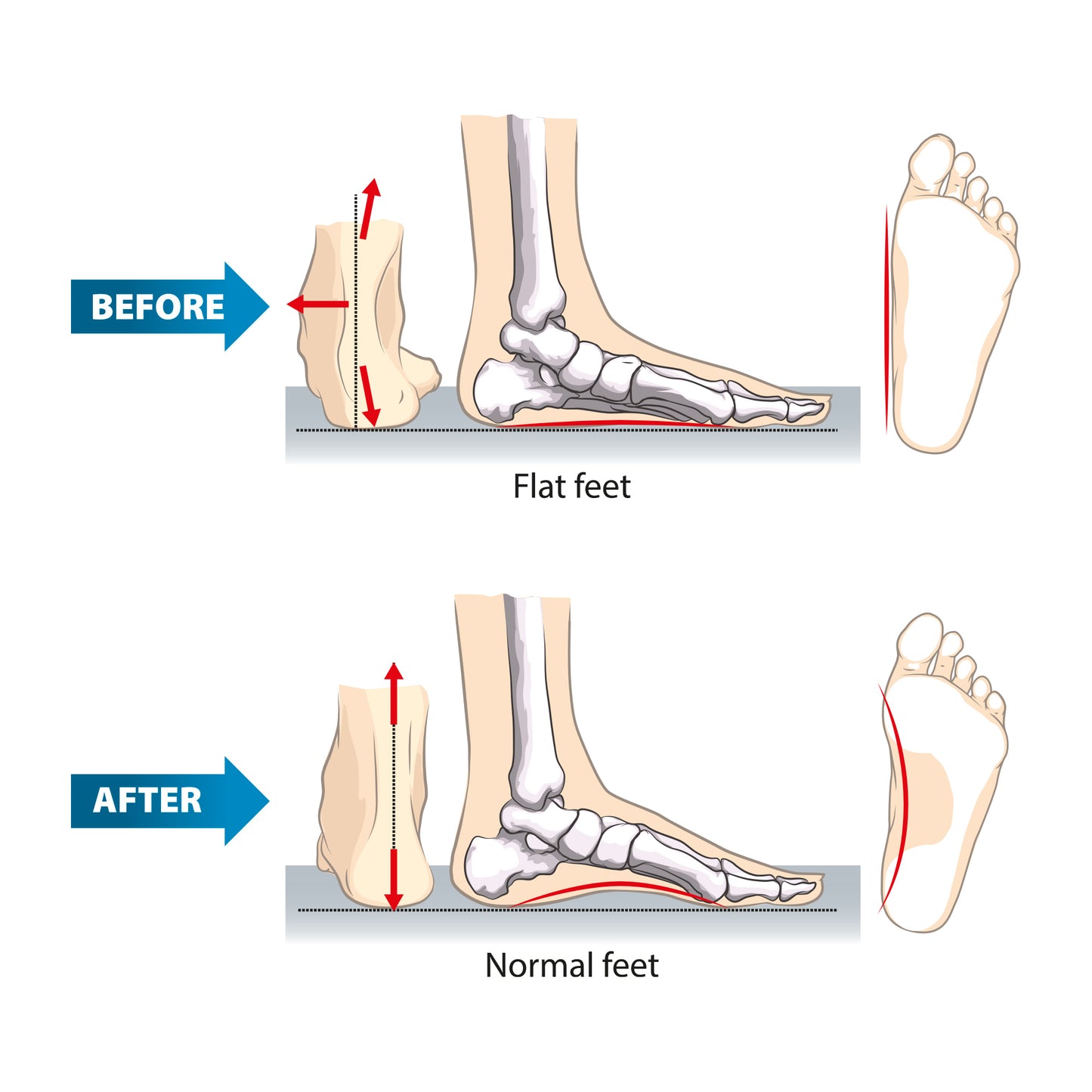 Memory Foam Comfort Insole 4D Cushioning - Insoleology