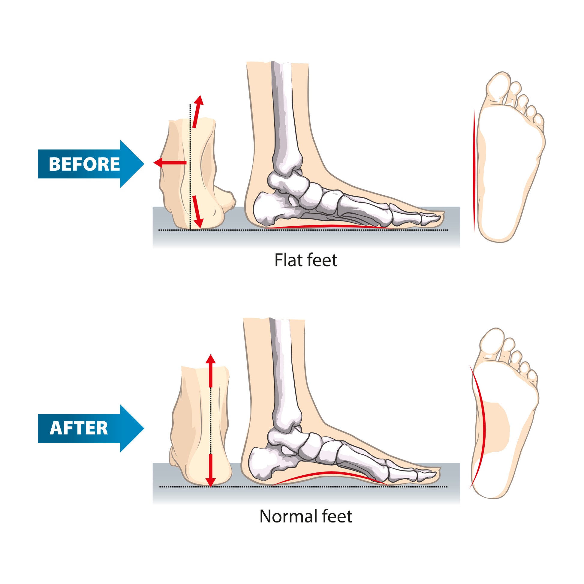 Memory Foam Comfort Insole 4D Cushioning - Insoleology